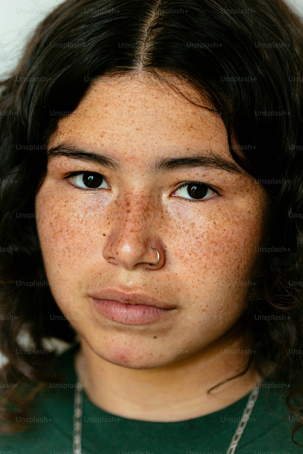 Freckles and birthmarks
